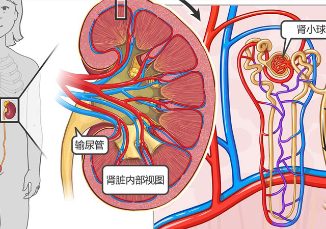 尿蛋白没有降到正常值，究竟会不会导致尿毒症？